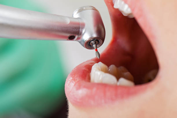 Best Emergency Cosmetic Dentistry in Douglasville, GA